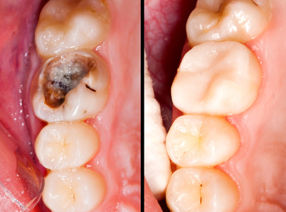 Stomatologia zachowawcza Łosice